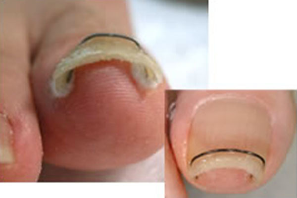 博多駅前まちかど皮膚科