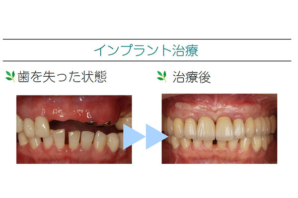 御殿場トーメイ歯科