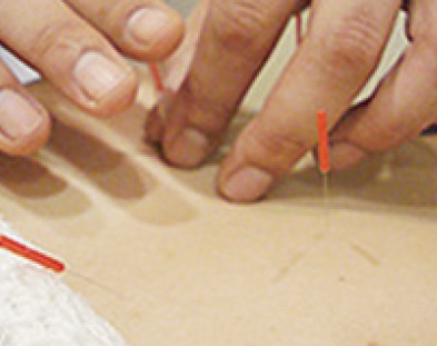 Relaxation 鍼灸みろく堂